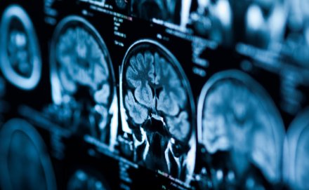 Ice Miller Helps TippingPoint Biosciences Raise $4.5 Million Seed Financing to Advance Epigenetic Drug Discovery in Pediatric Brain Cancer